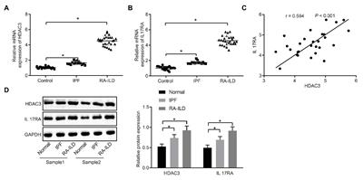 Histone Deacetylase 3-Mediated Inhibition of microRNA-19a-3p Facilitates the Development of Rheumatoid Arthritis-Associated Interstitial Lung Disease